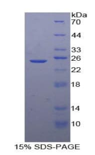 Human SDF2 Protein (Recombinant His-T7)