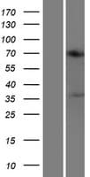 ACOT11 / THEA Protein (Over-Expression Lysate Myc-DDK (Flag))