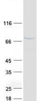 Human BIRC3 / cIAP2 Protein (Recombinant Myc-DDK (Flag))