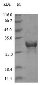 Chikungunya virus Polyprotein nsP1234 (Recombinant 6His, N-terminus)