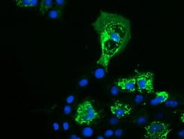 P5CR2 / PYCR2 Antibody (clone OTI3D1)