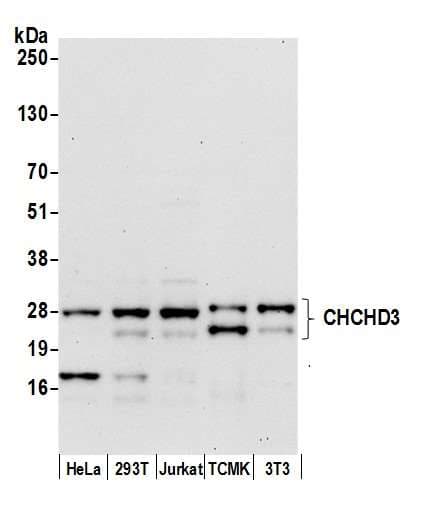 Polyclonal Rabbit anti-Human CHCHD3 Antibody (aa177-227, WB)