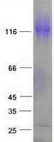 Human EML4 Protein (Recombinant Myc-DDK (Flag))
