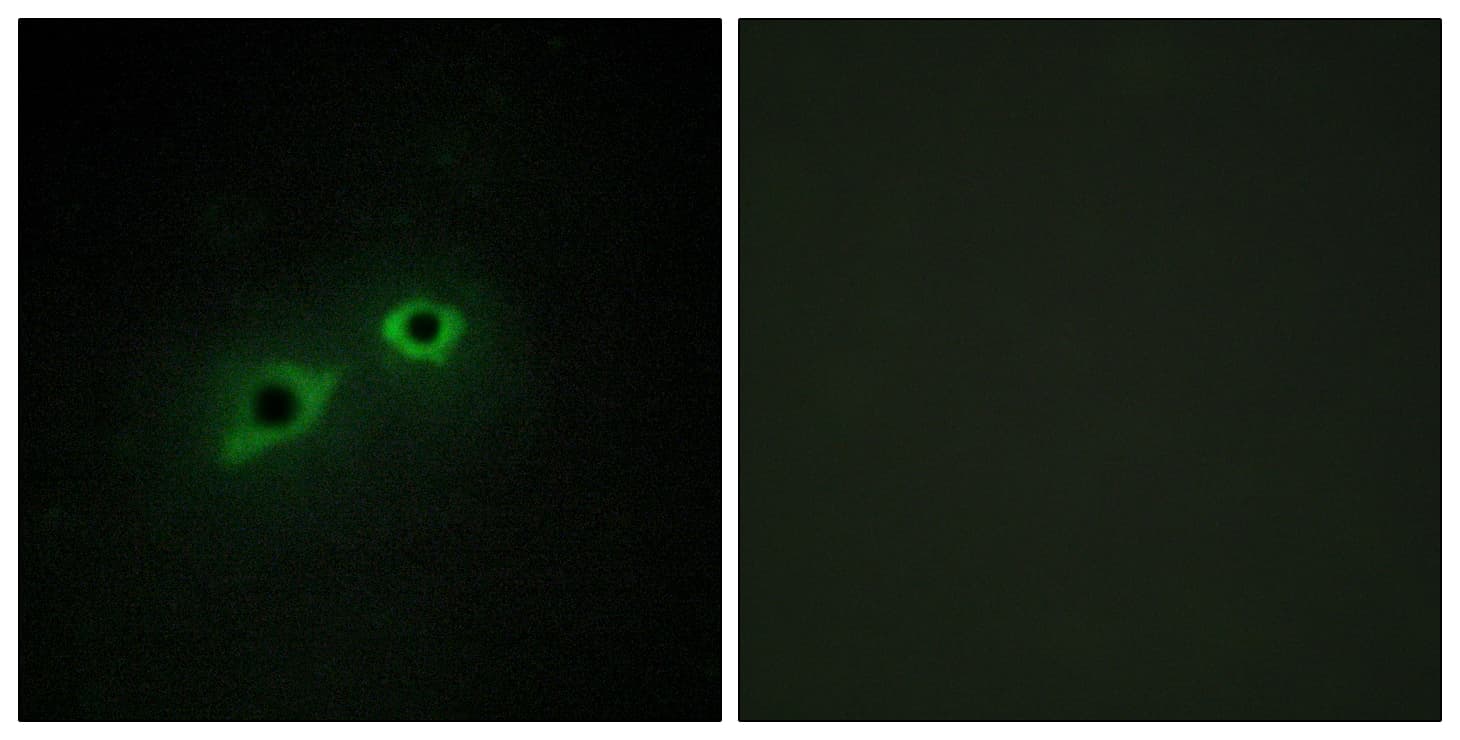 IHC-plus™ TMPRSS15 / Enterokinase Antibody (aa81-130)