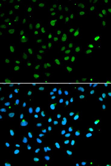 SMARCA4 / BRG1 Antibody