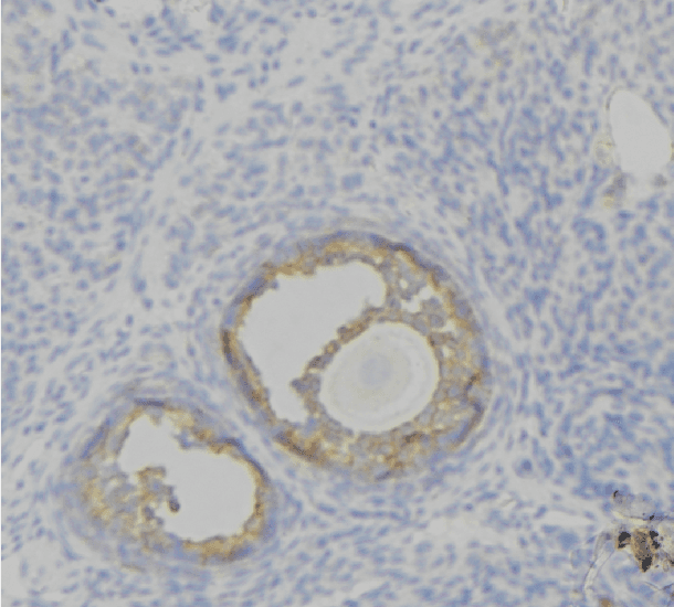 F12 / Factor XII Antibody