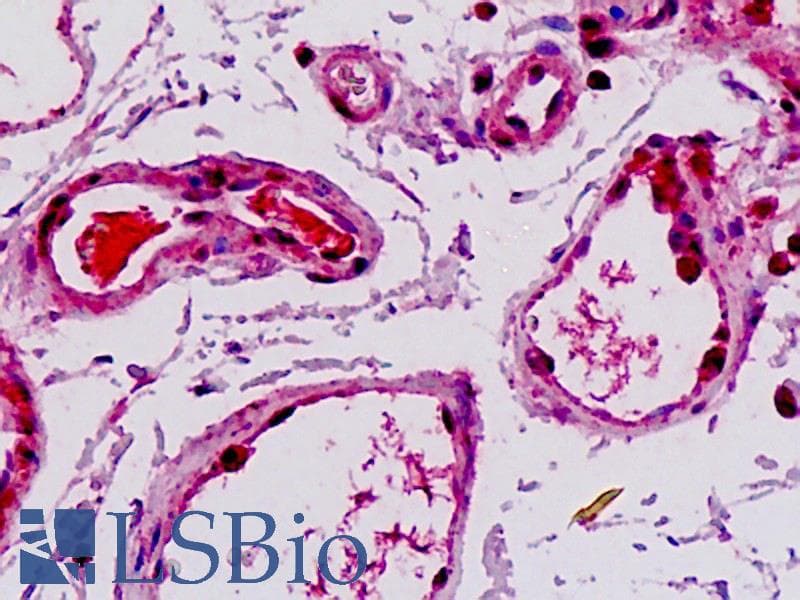 IHC-plus™ Polyclonal Rabbit anti-Human FLT1 / VEGFR1 Antibody (N-Terminus, IHC, WB)