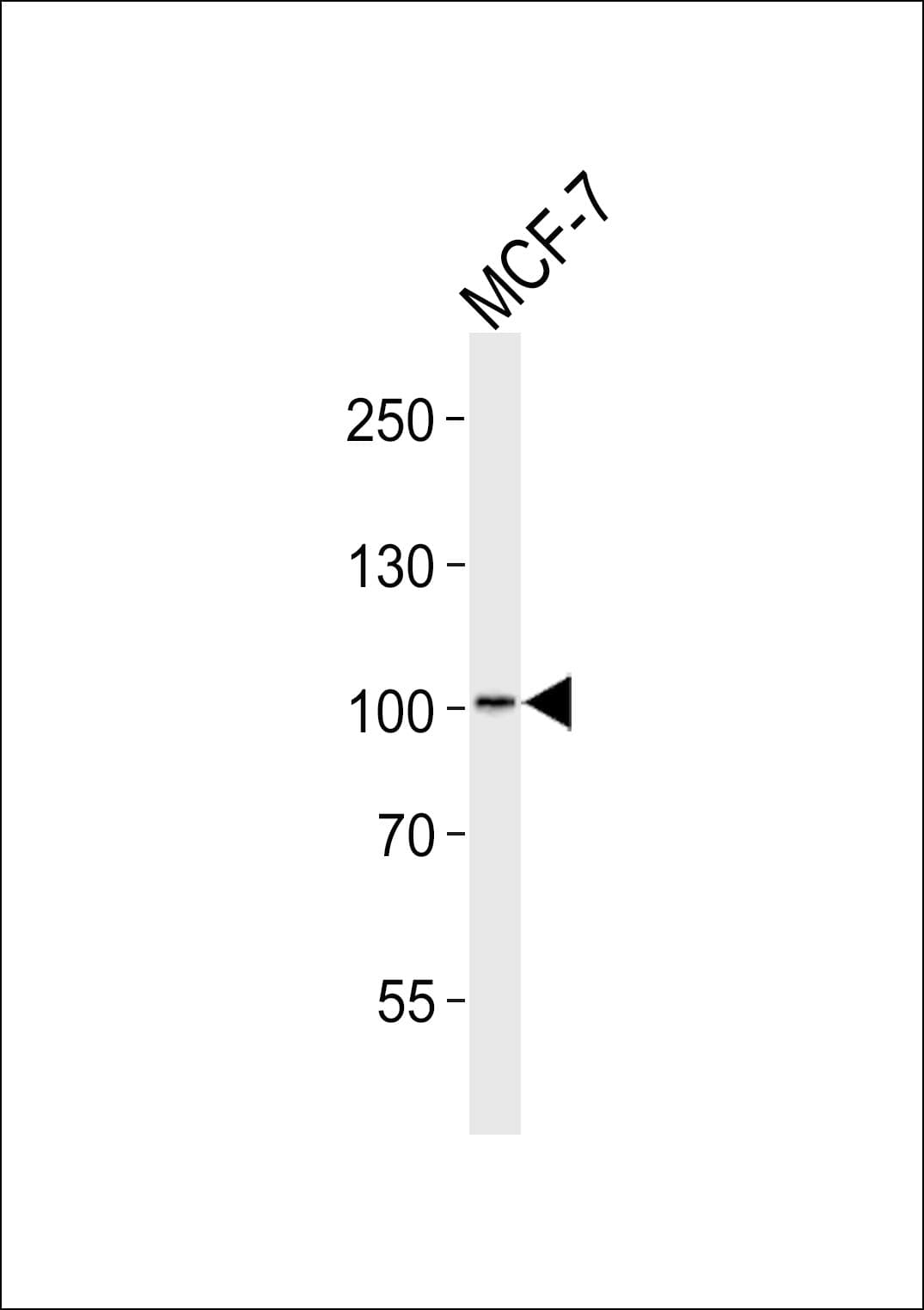 MORC2 Antibody (aa828-862)