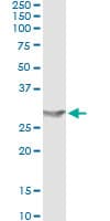 Monoclonal Mouse anti-Human APOA1 / Apolipoprotein A 1 Antibody (clone 3A11-1A9, WB)