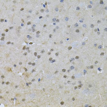 NRF1 / NRF-1 Antibody