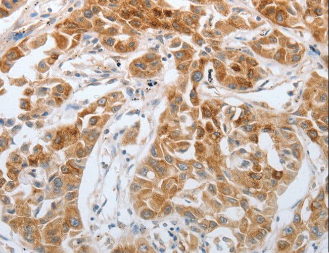 RTN4 / Nogo Antibody