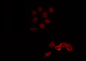 Polyclonal Rabbit anti-Human LMX1B Antibody (IF, WB)