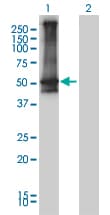 IHC-plus™ ARRB2 / Beta Arrestin 2 Antibody (clone 3G1)