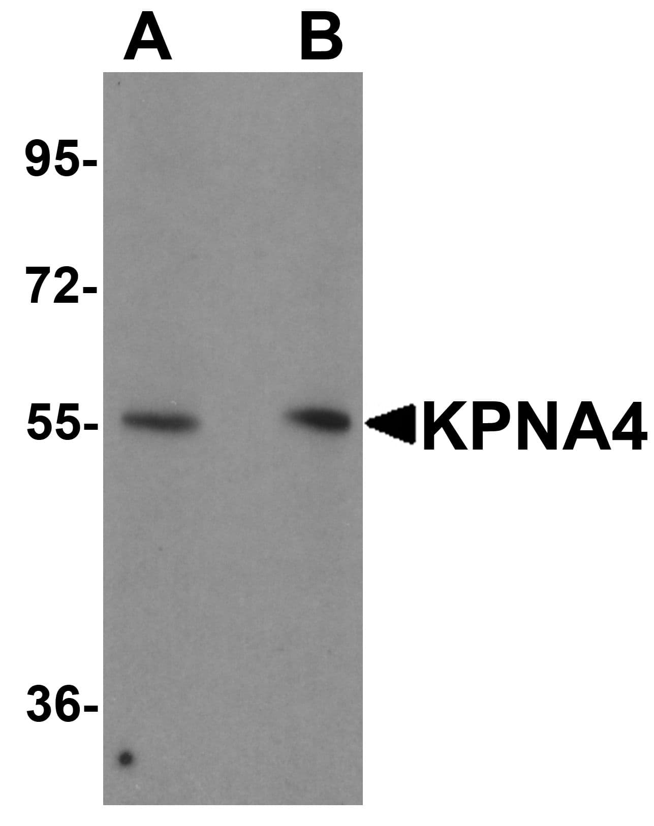 IHC-plus™ QIP1 / KPNA4 Antibody