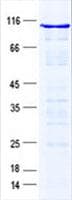 Human PPP1R10 / PNUTS Protein (Recombinant His, N-Terminal)