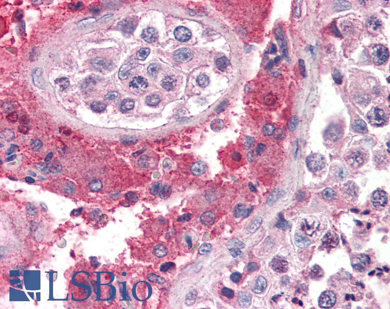 IHC-plus™ SET / TAF-I Antibody (aa2-15)