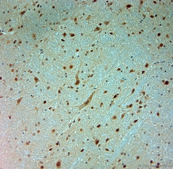 ARX Antibody (aa2-50)