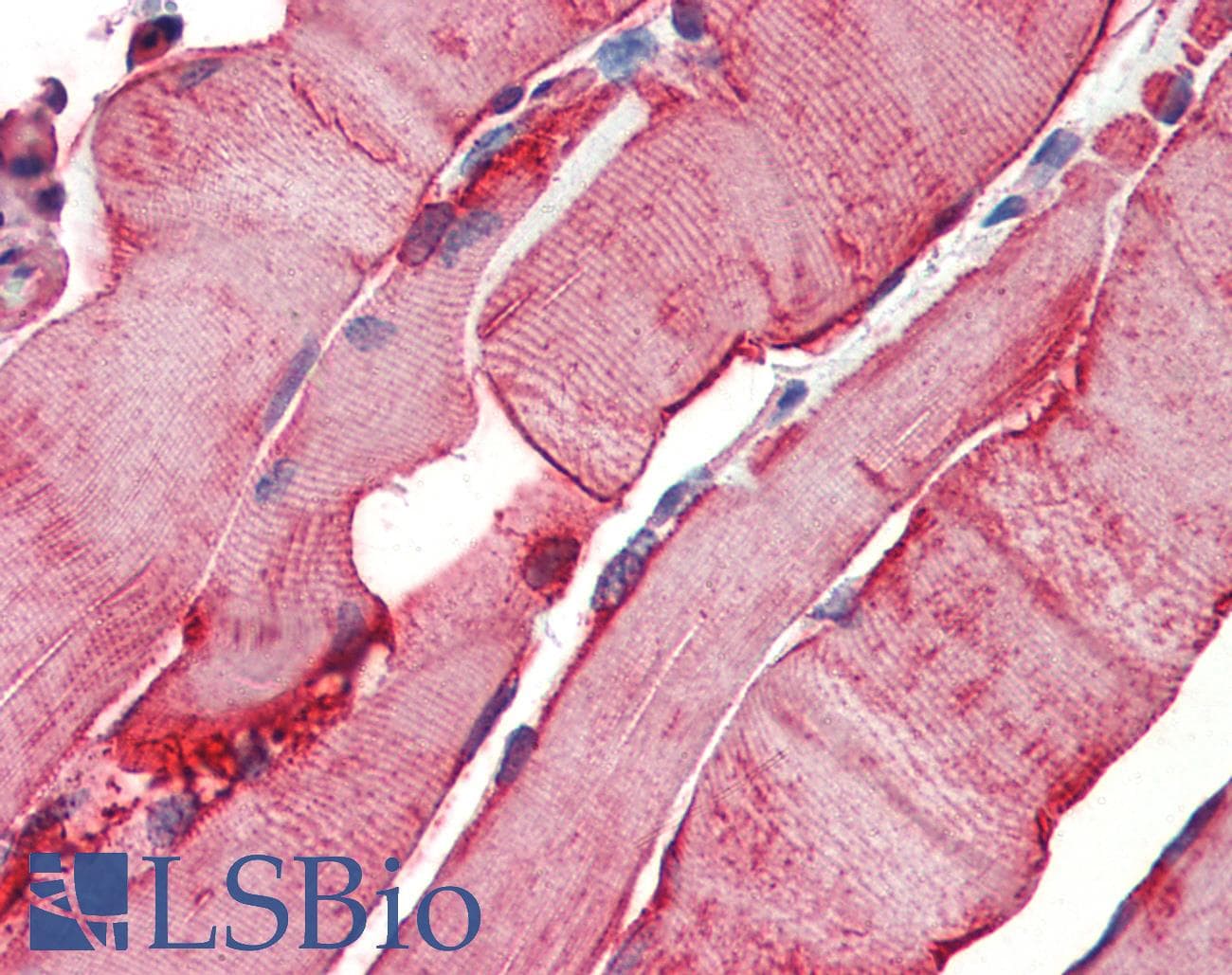 IHC-plus™ HSPB1 / HSP27 Antibody
