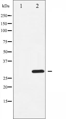 CCND3 / Cyclin D3 Antibody