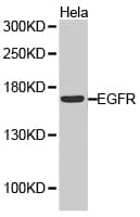 Polyclonal Rabbit anti-Human ATOH1 / MATH-1 Antibody (WB)