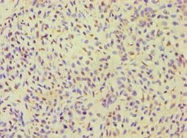 ALOXE3 Antibody (aa1-280)