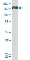 MLLT10 Antibody (clone 6H8)