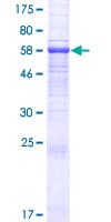 Human OPCML / OBCAM Protein (Recombinant GST)