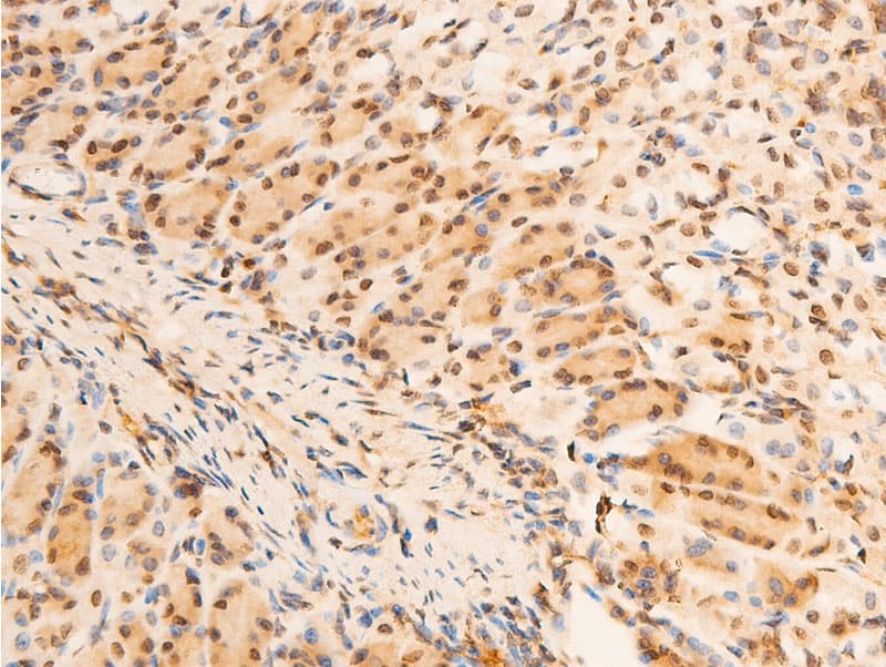 Polyclonal Rabbit anti-Human NFKBIA / IKB Alpha / IKBA Antibody (phospho-Ser32,phospho-Ser36, IHC, IF, WB)