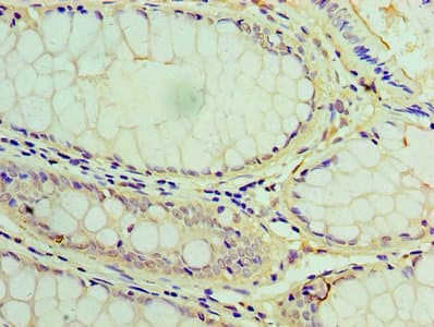 Polyclonal Rabbit anti-Human LIPA / Lysosomal Acid Lipase Antibody (aa22-399, WB)