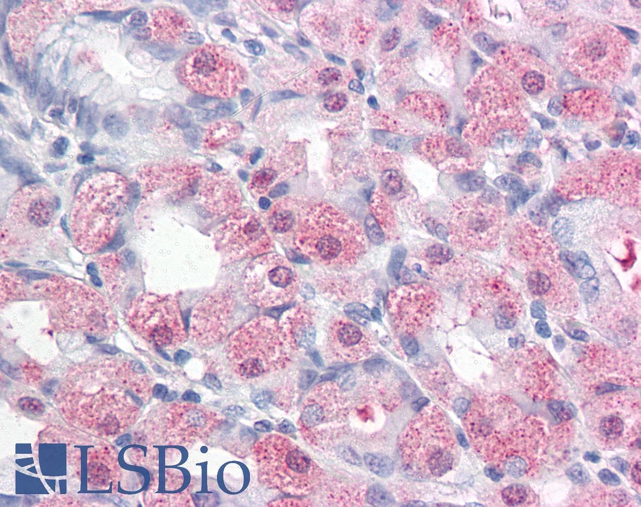 IHC-plus™ Polyclonal Rabbit anti-Human ERMP1 Antibody (Internal, IHC)
