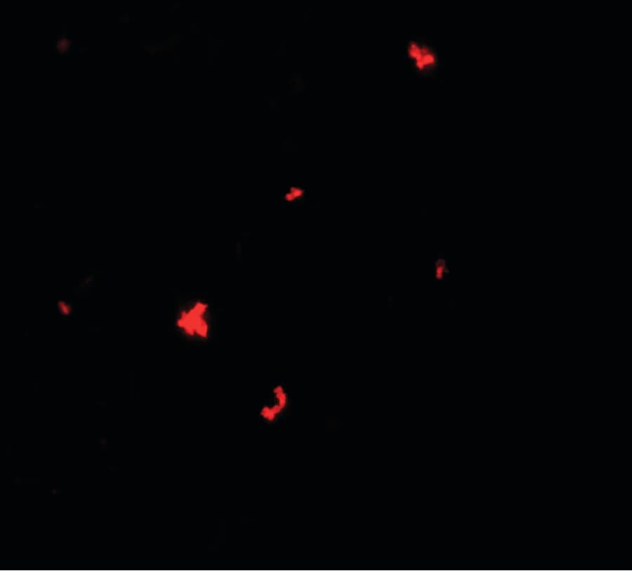 IHC-plus™ Polyclonal Rabbit anti-Human SCOP / PHLPP Antibody (IHC, IF, WB)