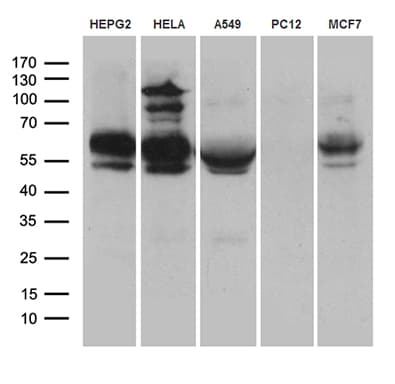 RNF149 Antibody (aa250-383, clone OTI8D7)