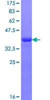 Human RABGAP1L Protein (Recombinant GST, N-terminus)