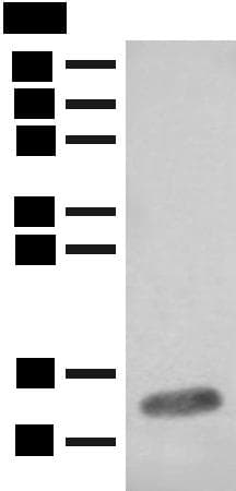 Polyclonal Rabbit anti-Human FABP4 / AP2 Antibody (IHC, WB)