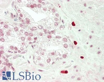 IHC-plus™ TBPL2 / TRF3 Antibody (aa67-116)