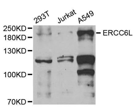 Polyclonal Rabbit anti-Human ERCC6L / FLJ20105 Antibody (WB)