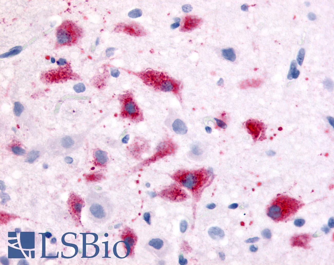 PathPlus™ CRFR1 / CRHR1 Antibody (N-Terminus)