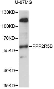 Polyclonal Rabbit anti-Human PPP2R5B Antibody (WB)