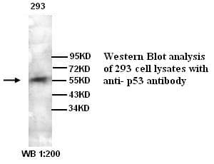 Polyclonal Rabbit anti-Human TP53 / p53 Antibody (WB)