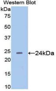 IL6 / Interleukin 6 Antibody (aa25-211)
