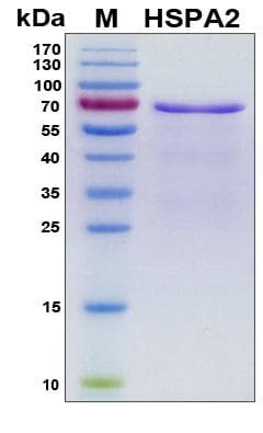 Human HSPA2 Protein (Recombinant His, N-Terminal)