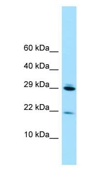 RPL28 / Ribosomal Protein L28 Antibody (N-Terminus)