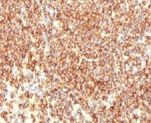 Monoclonal Mouse anti-Human CD20 Antibody (clone CDLA20-1, IHC, IF)
