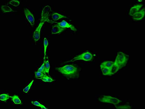 SGK1 / SGK Antibody