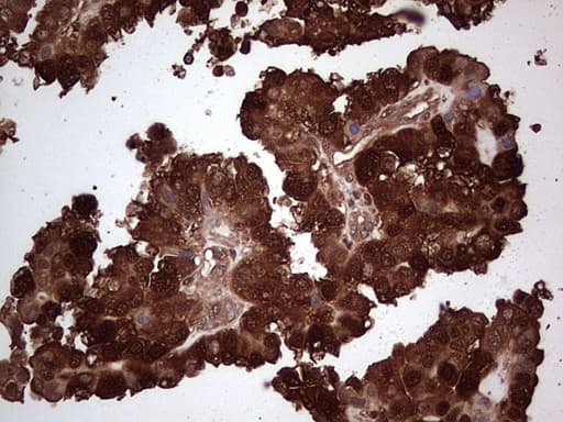 Monoclonal Mouse anti-Human LGALS3 / Galectin 3 Antibody (clone OTI2F1, Carrier-free, IHC, WB)