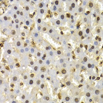 Cullin 4B / CUL4B Antibody