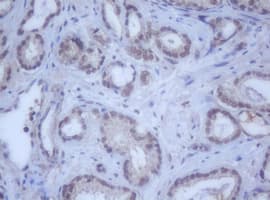 Monoclonal Mouse anti-Human DDX59 Antibody (clone OTI2G1, IHC, WB)
