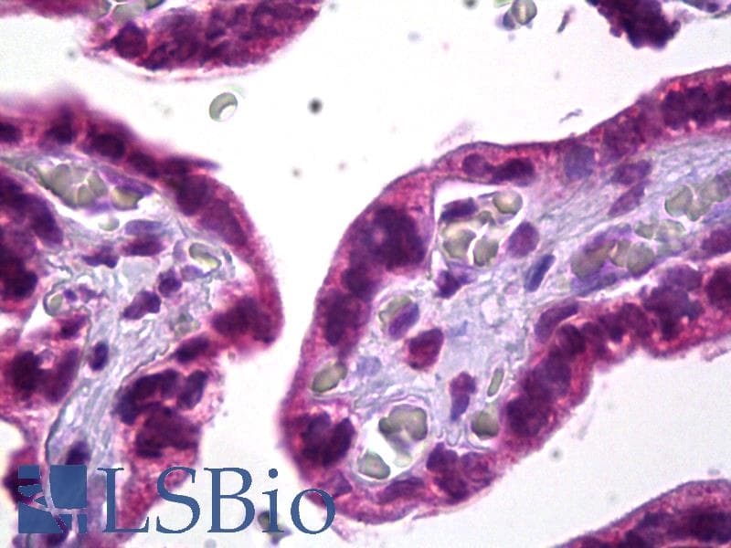 IHC-plus™ Monoclonal Mouse anti-Human SKI Antibody (clone G8, IHC, WB)