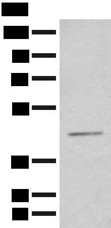 HENMT1 Antibody