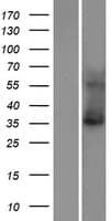 KCNK15 Protein (Over-Expression Lysate Myc-DDK (Flag))